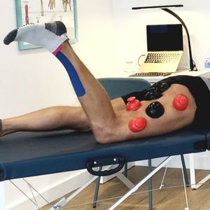 Myofascial Cupping