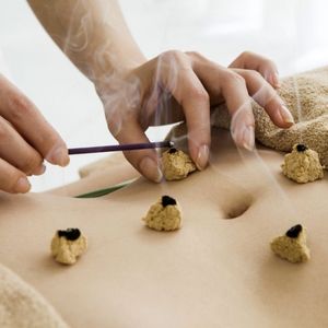 Moxibustion treatment – promoting the free flow of Qi (energy) in the body