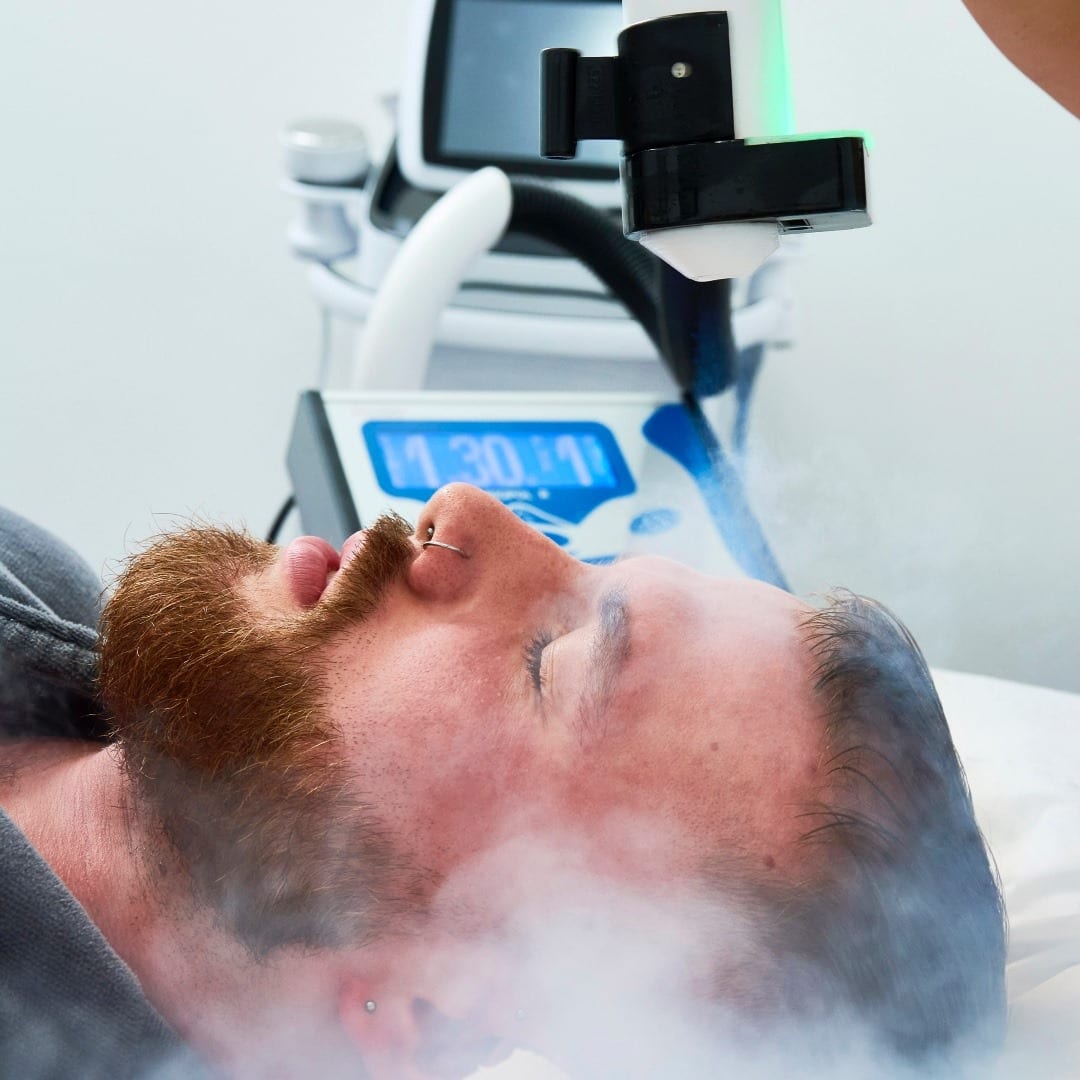 Cryo Facial
