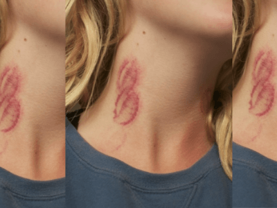 I will give you lip shaped lovebite